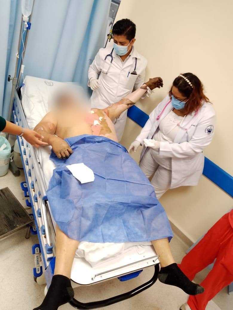 Hospital photo after the fire, with the patient's face blurred